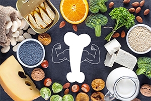 Joint Replacement Nutrition: The Best and Worst Foods for Healing