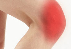 Anterior Knee Pain