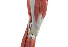 BackinAction Knee